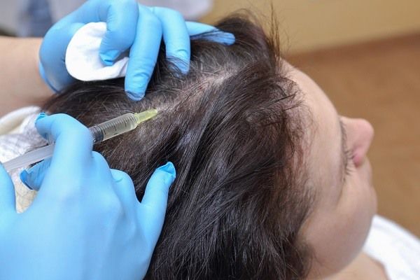 ما هو بوتكس الشعر وما هي أهم فوائده واستخداماته | تجميلي
