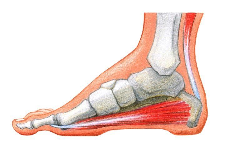 علاج بروز عظمة القدم