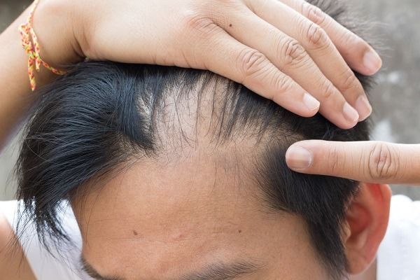 بطاقة بريدية ارتبك ميكروب  كيفية علاج تساقط الشعر 2021 | الأسباب وطرق العلاج | تجميلي