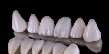تركيبات الاسنان البورسلين