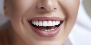 كل ما يخص شكل الاسنان الطبيعية لابتسامة ساحرة