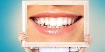 مشكلة اعوجاج الاسنان وعلاجها