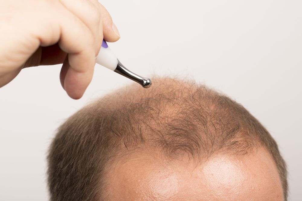 فيلر الشعر التقنية والتكلفة ونتائج حقن الفيلر للشعر تجميلي