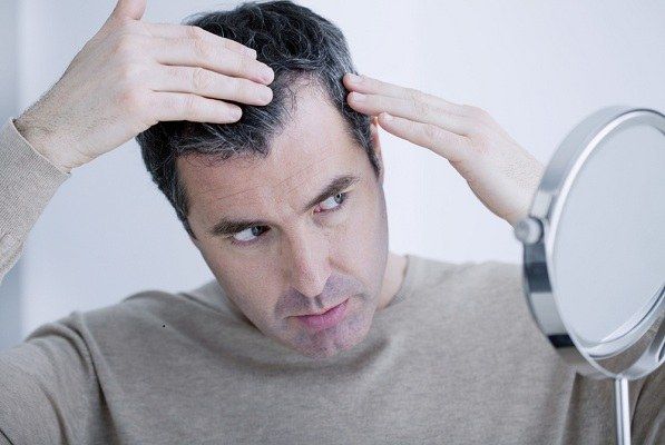 اسباب تساقط الشعر عند الرجال ما هو سبب تساقط الشعر للرجال تجميلي