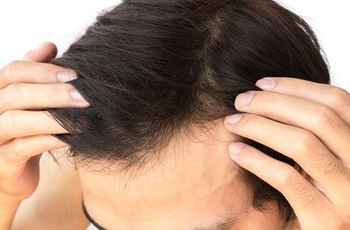 علاج الشعر الجاف والخشن