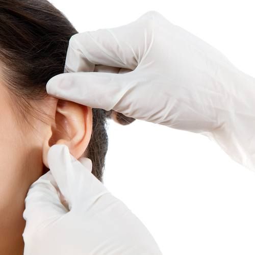 علاج بروز الأذن بالخيوط