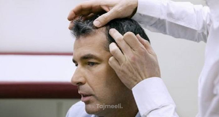 افضل دكتور زراعة شعر في تركيا 2021 تجميلي