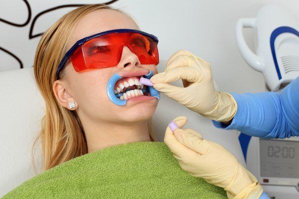 أفضل مراكز تبييض الأسنان في مصر