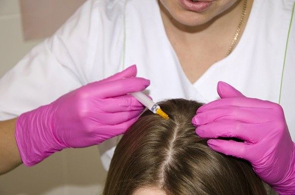 فيلر الشعر | التقنية والتكلفة ونتائج حقن الفيلر للشعر | تجميلي