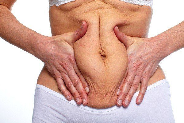 علاج تمدد الجلد الاسباب وطرق الطبية وأكثر تجميلي