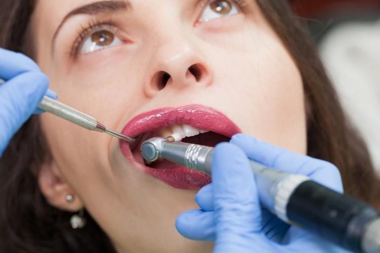  ما هي أبرز المشاكل المحتملة لتيجان الأسنان ؟