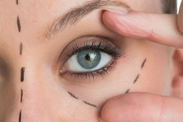 ماهي عملية تكبير و توسيع العيون؟