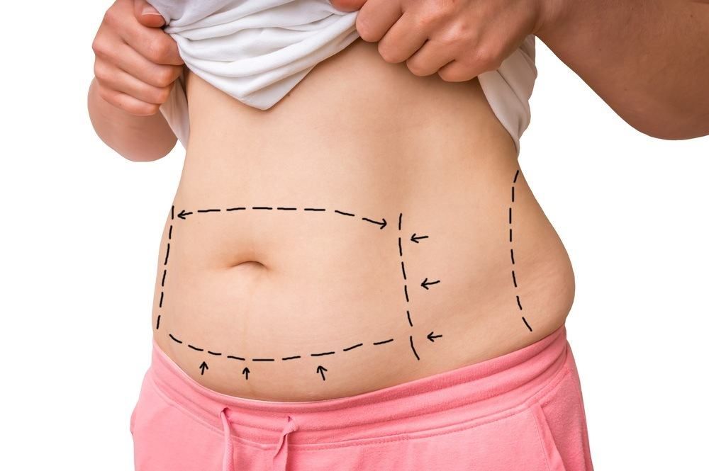 أسباب تراكم الدهون في منطقة البطن