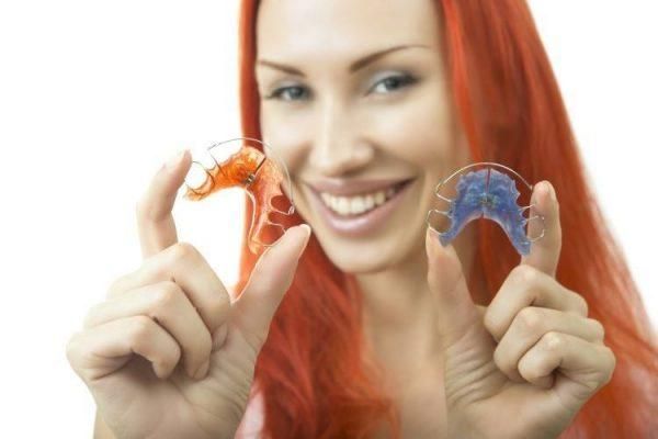 أنواع عمل تقويم الاسنان الثابت
