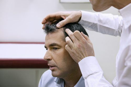 كيف يتم احتساب معدل تساقط الشعر لدى الرجال