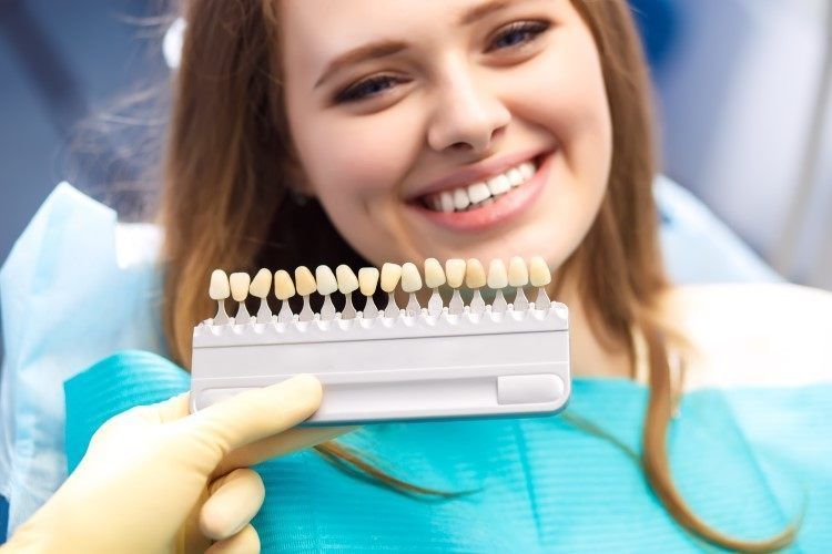عمليات عدسات الاسنان (ابتسامة هوليود) وأنواعها