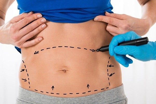 معلومات عن عملية تجميل البطن - سطور