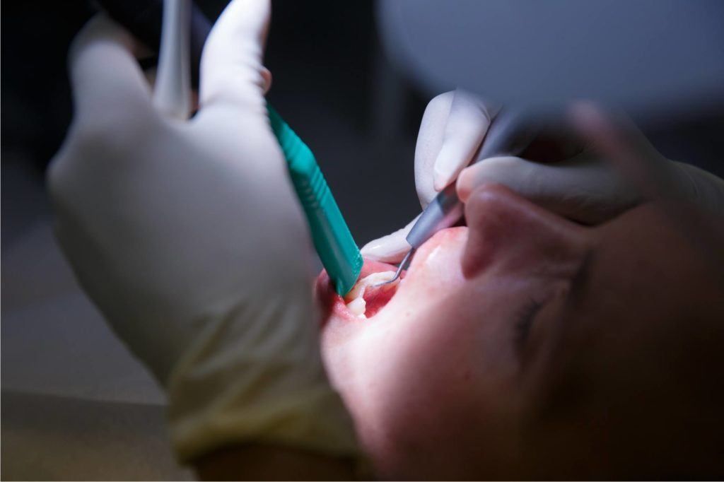 كيف تختار طبيب الأسنان المناسب لإجراء عملية تصغير الأسنان ؟