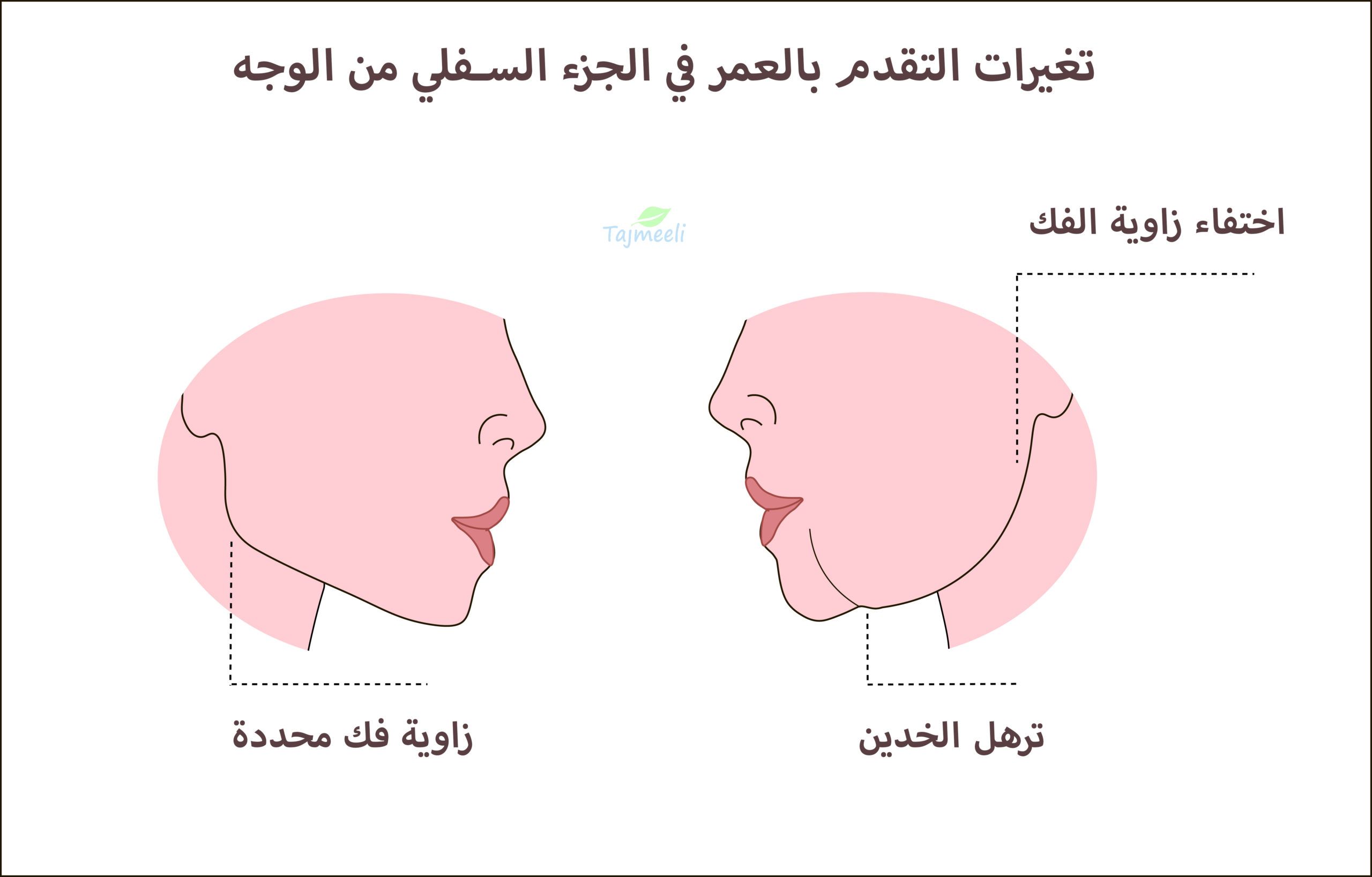 كيفية علاج ترهل الوجه
