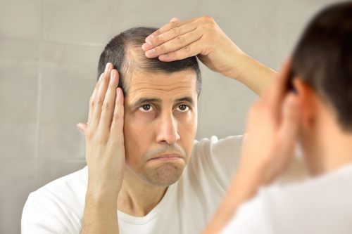 ما هي أسباب تساقط الشعر والصلع ؟