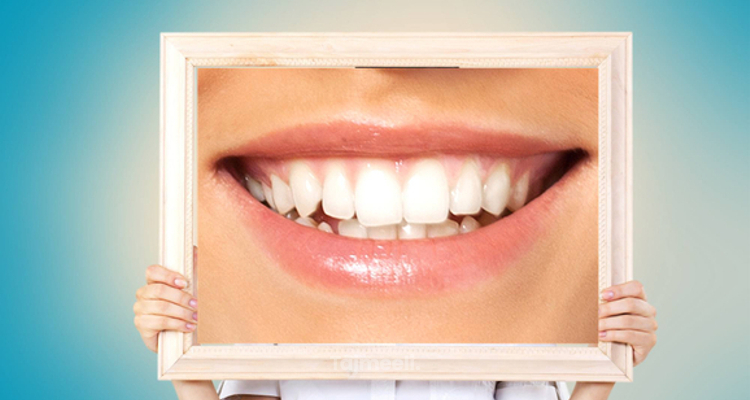عمليات الاسنان التجميلية | الفينير والتقويم والتبييض | تجميلي