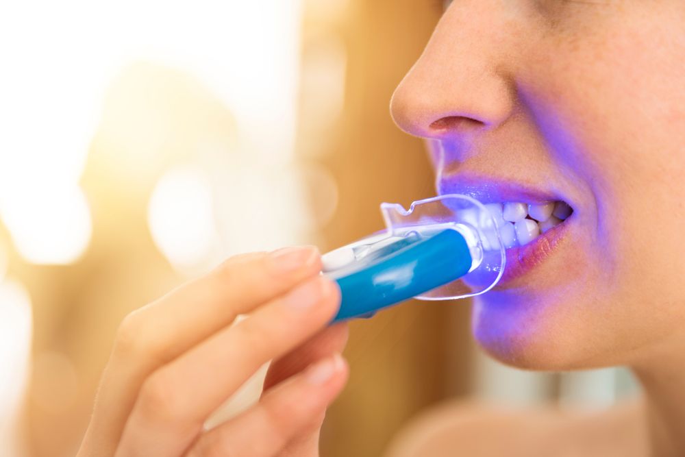 أسباب حساسية الأسنان أثناء التبييض