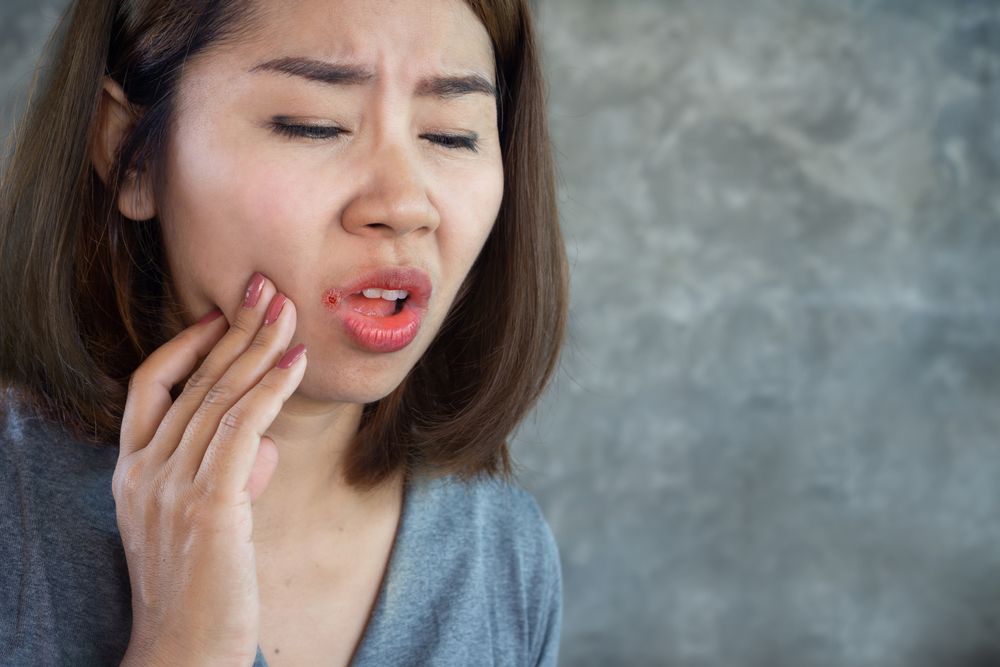 أعراض تشقق زوايا الفم