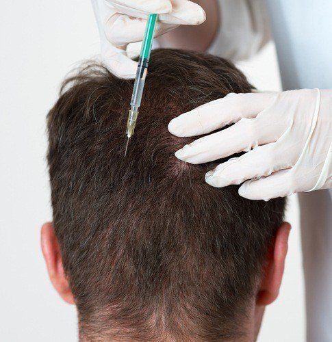 امبولات ترميم وإعادة بناء الشعر