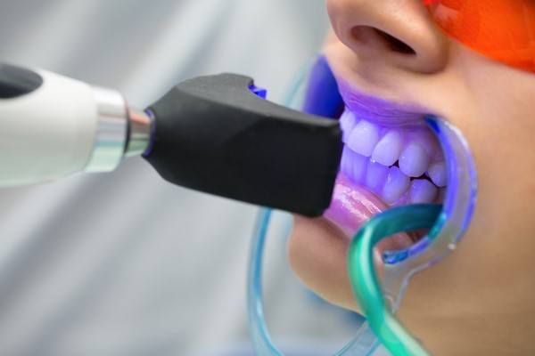 كيف يمكن تبييض الأسنان بدون ألم؟