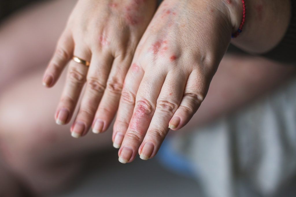 ما هي العوامل التي تُعرض يديكِ للجفاف والتلف؟ 