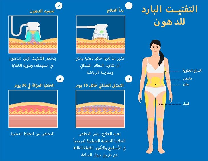 معلومات عن عملية شفط الدهون بالفيزر في الرياض