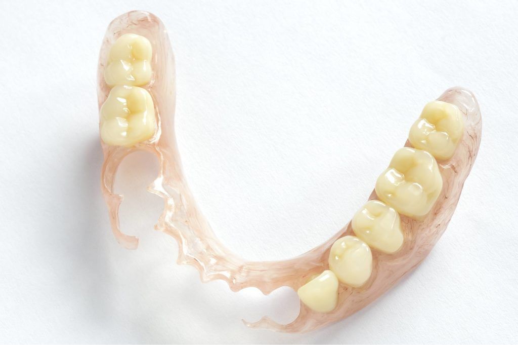 تركيبات الأسنان الجزئية المتحركة