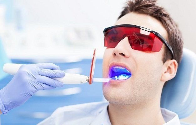 ما هي الحشوات الضوئية للأسنان؟
