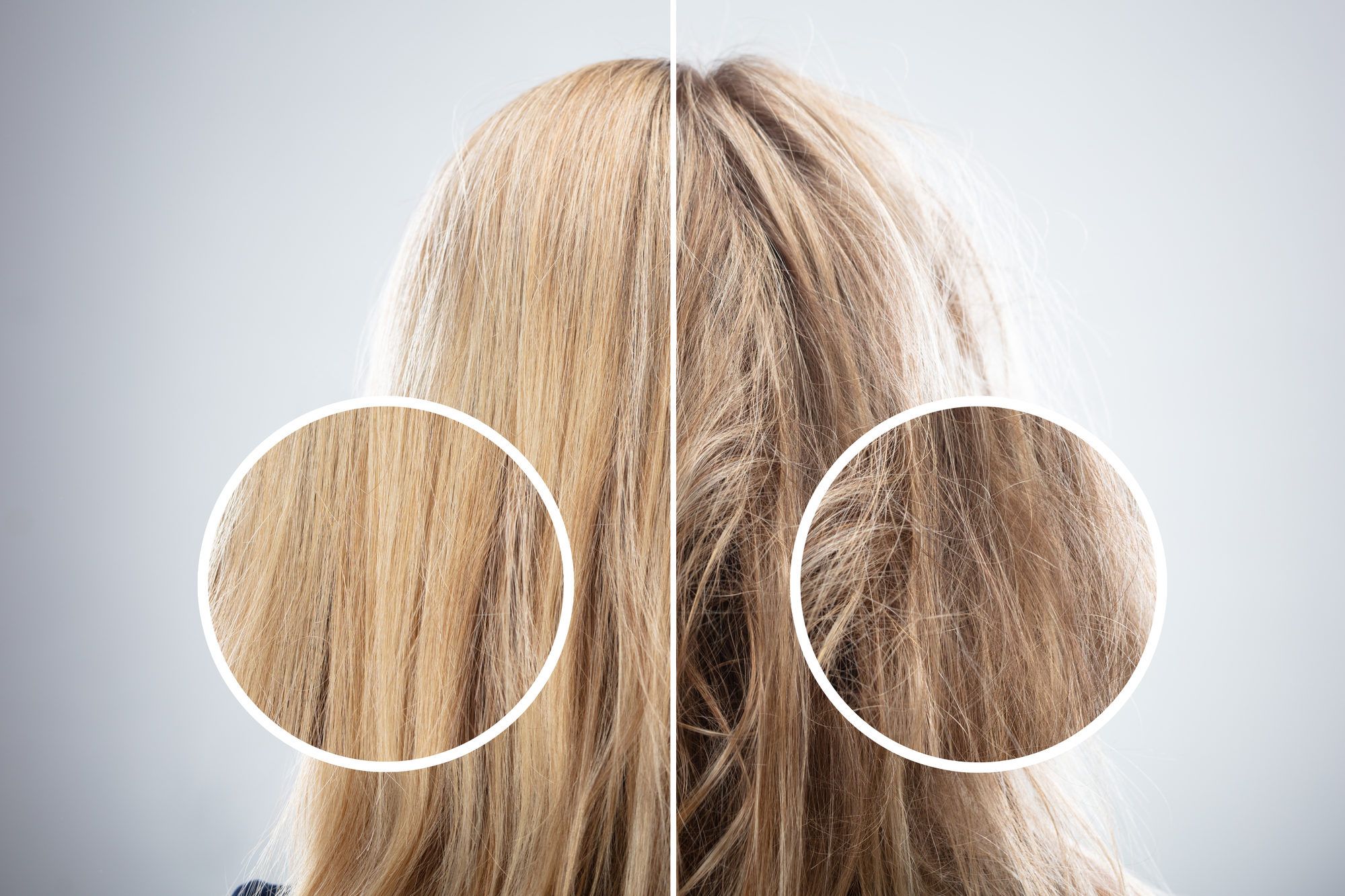 فوائد الديرما ستامب زيادة طول الشعر