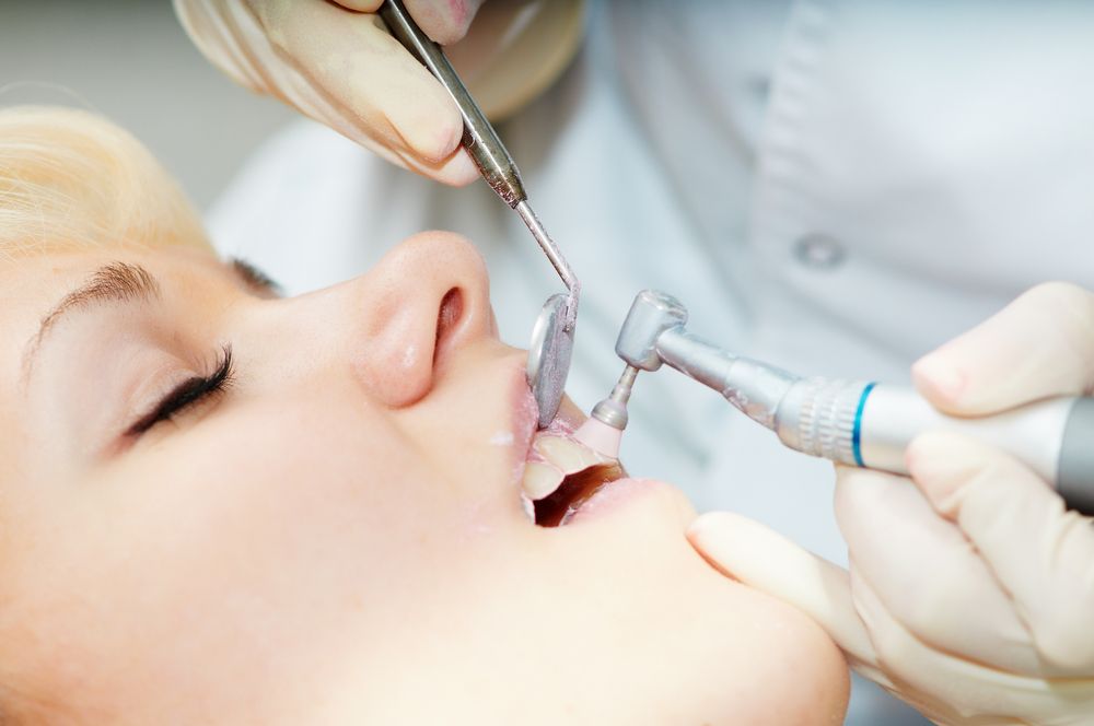تقنيات تلميع الاسنان