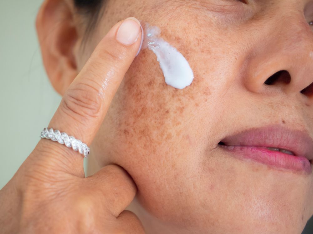طرق علاج تصبغات الجلد