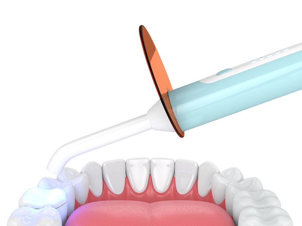 ما هي الحشوات الزجاجية للأسنان؟