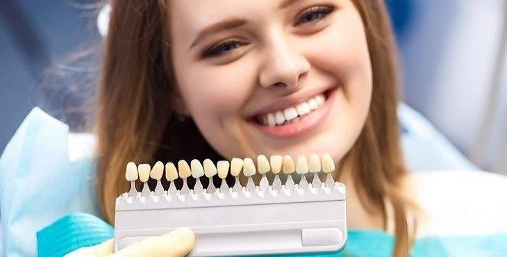 الآثار الجانبية لفينير الاسنان