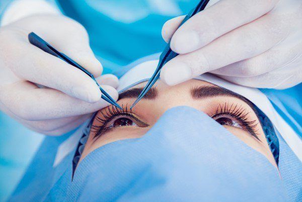 ⁨‎⁨عملية تجميل العيون الجاحظة الجراحية⁩⁩