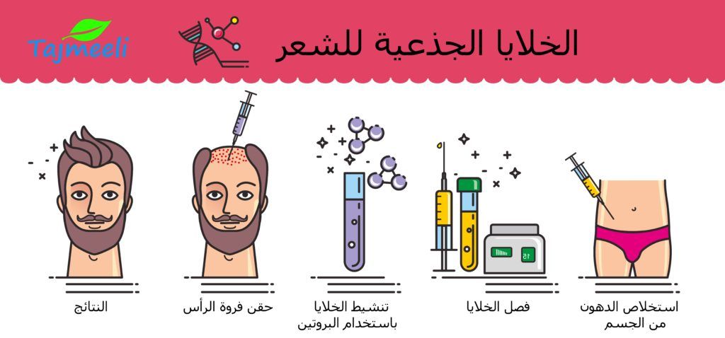 ما يجب أن تعرفه عن الخلايا الجذعية للشعر في الإمارات