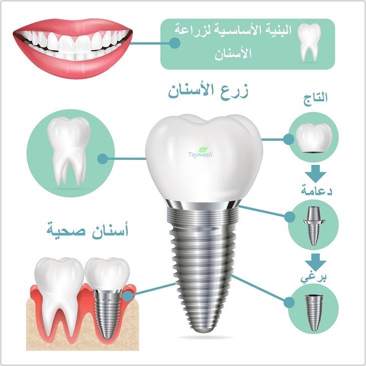 أفضل عيادة أسنان في أبو ظبي