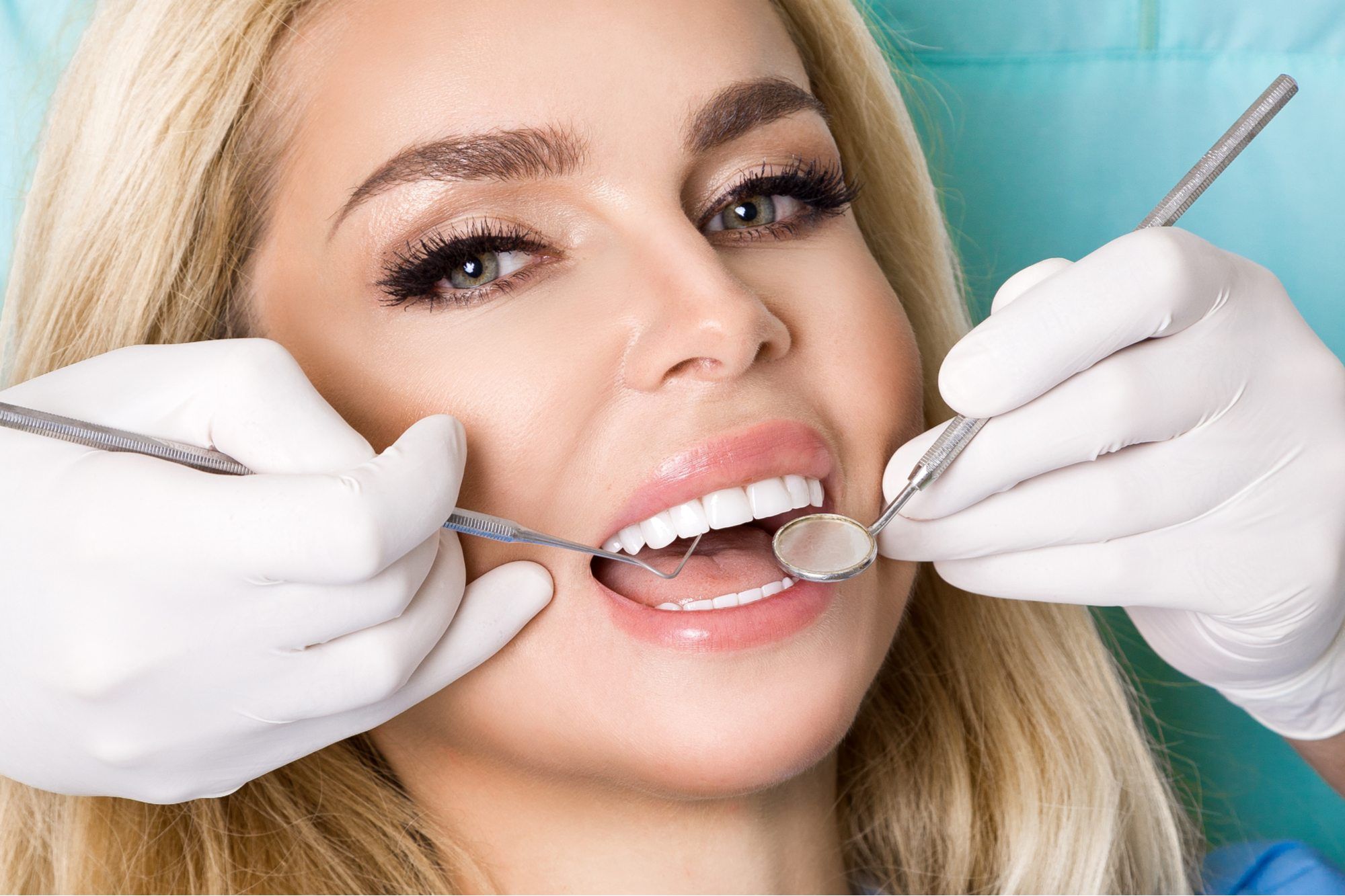 جراحات الأسنان التجميلية