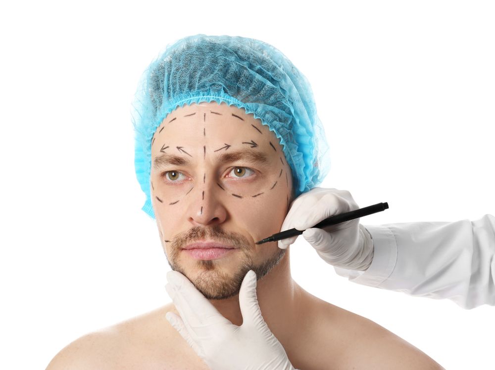 نبذة عن عمليات تنحيف الوجه للرجال (Cheek Liposuction) في تركيا