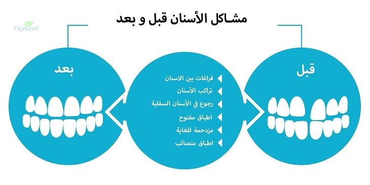 الحشوات التجميلية في الرياض المراكز والمميزات والتكلفة تجميلي