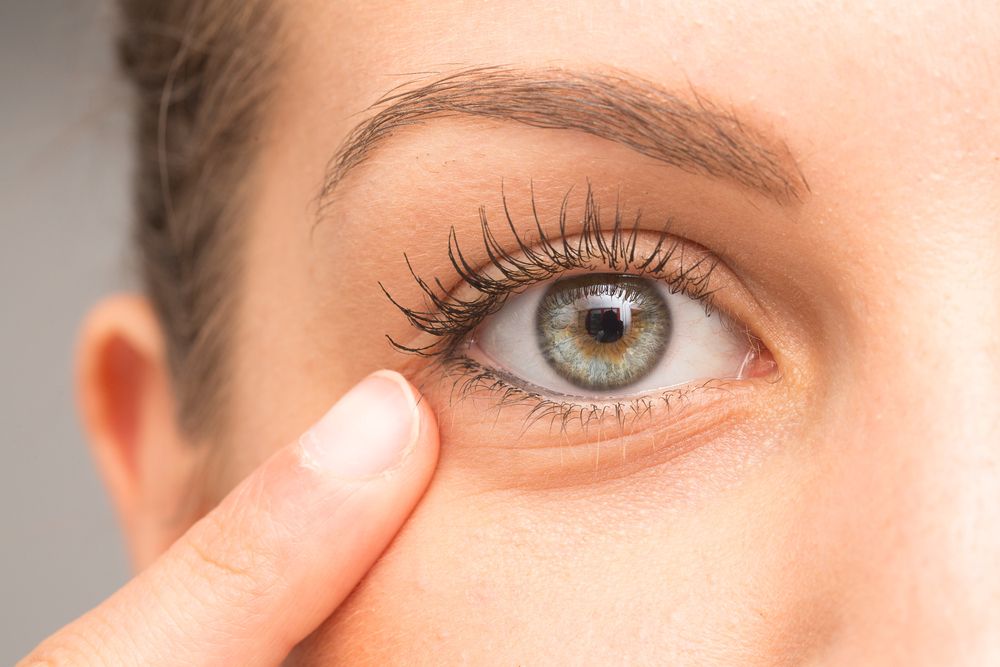 الوقاية من الإصابة بالكيس الدهني بالعين