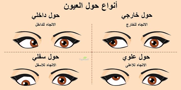 انواع حول العيون