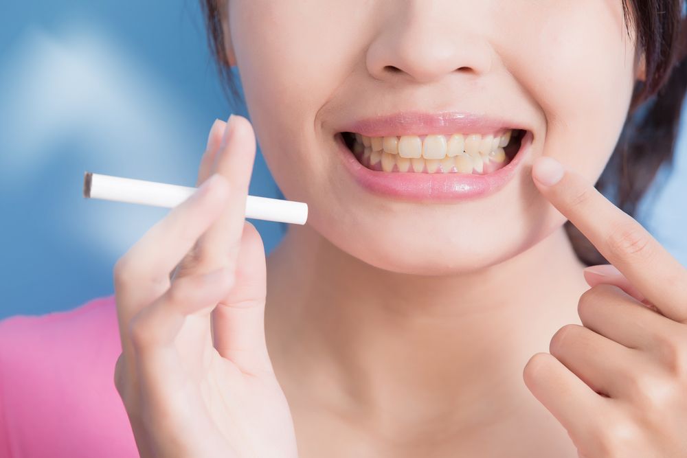 التدخين من اسباب ارتفاع اللثة عن الأسنان