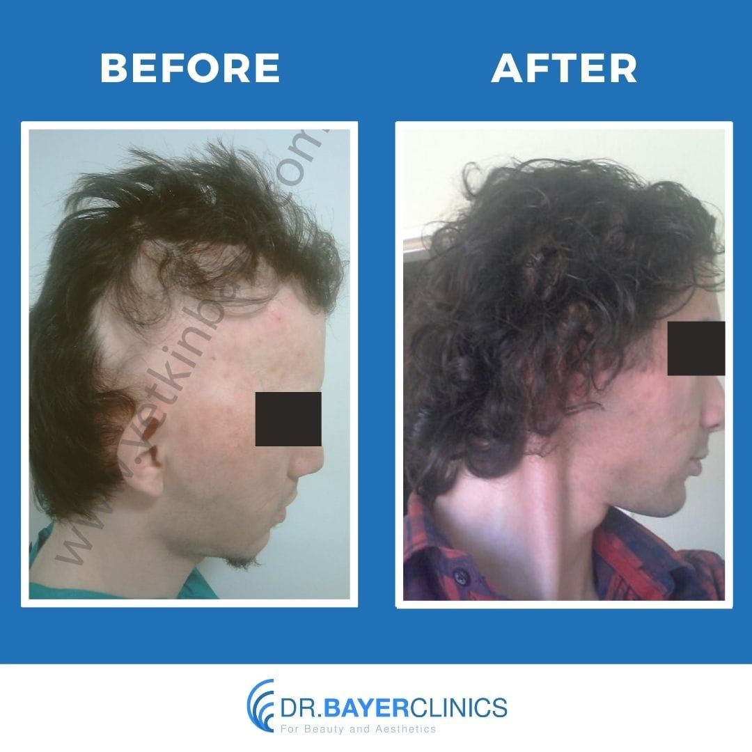 Photo from Dr. Bayer Clinics