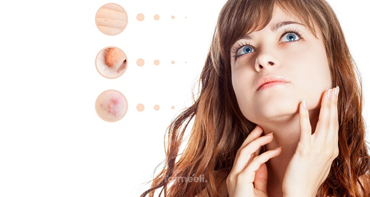 تخلص من مشاكل الجلد والشعر مع 8 من أقوى علاجات الأمراض الجلدية