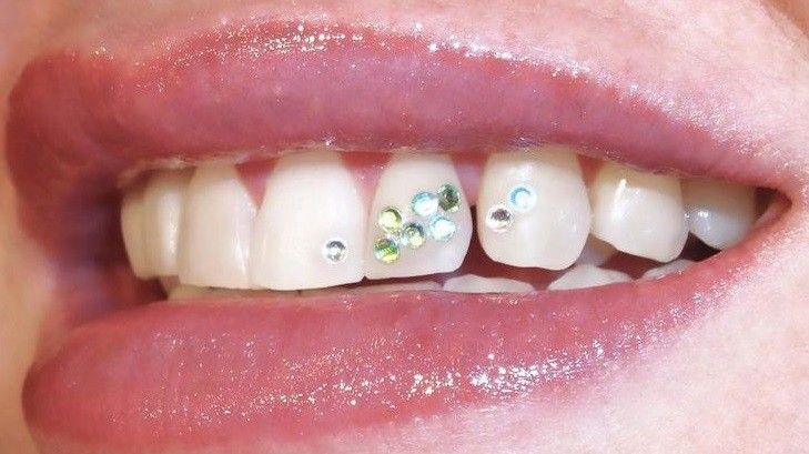 ما هي أشكال ستراس الأسنان